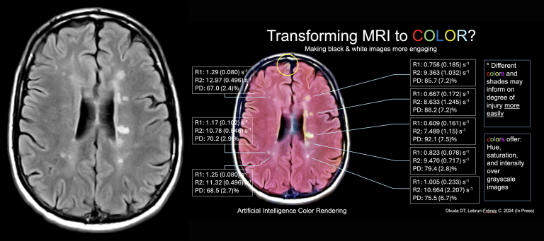 grayscale to color mri