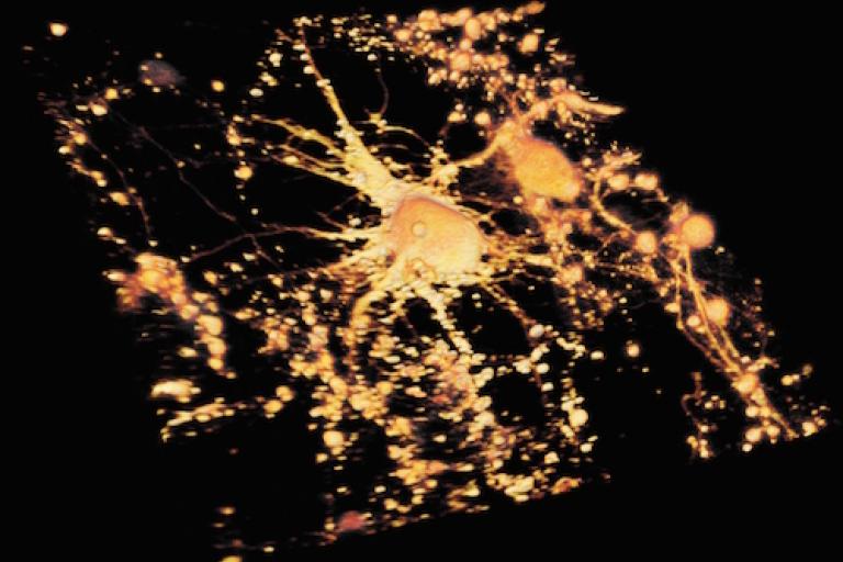 Neurons
