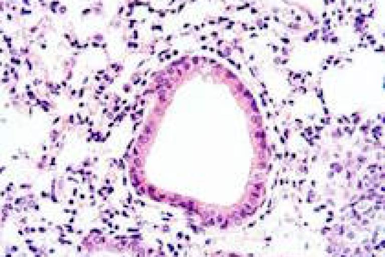 Stained cells