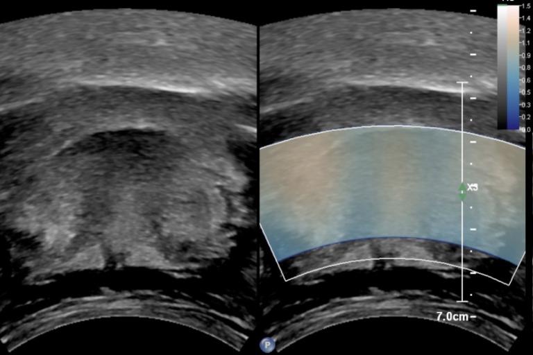 2 ultrasounds