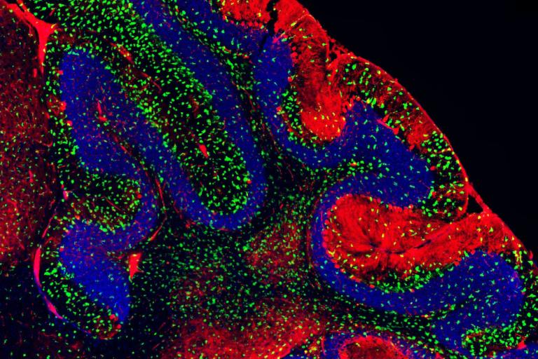 NPC1 cerebellum