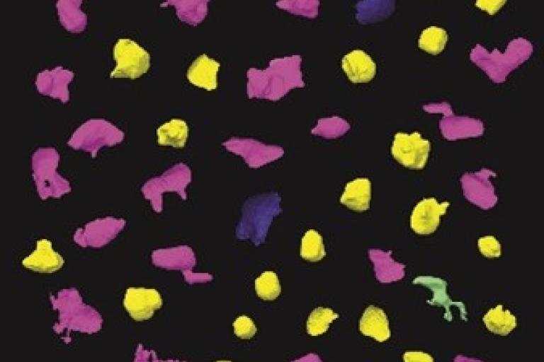 Gallery of cell shapes from Ewing sarcoma xenografts
