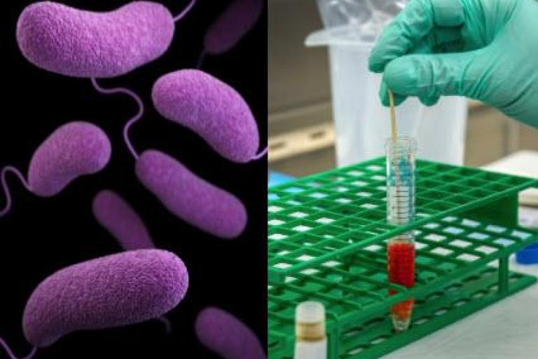 Gut-Brain Axis Research