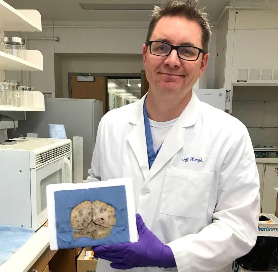Jeffrey Waugh, M.D., Ph.D. holding a brain