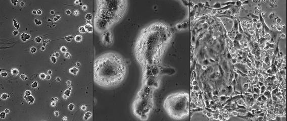 Cellular mechanotransduction