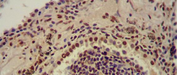 Epigenetic reprogramming