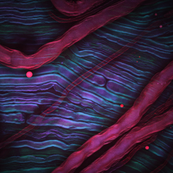 Coherent Raman imaging of nerve alignment