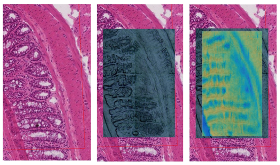 Raman tissue mapping, overlay of mouse colon histology, birghtfield microscopy, and Raman amino acid signal.