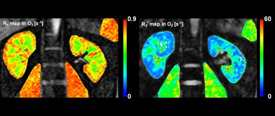 Oxygen-enhanced MRI of human organs