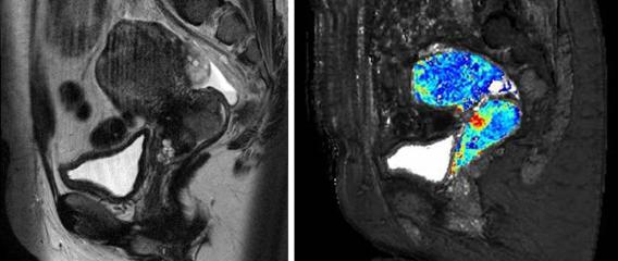 Oxygen-enhanced MRI of human sagittal section
