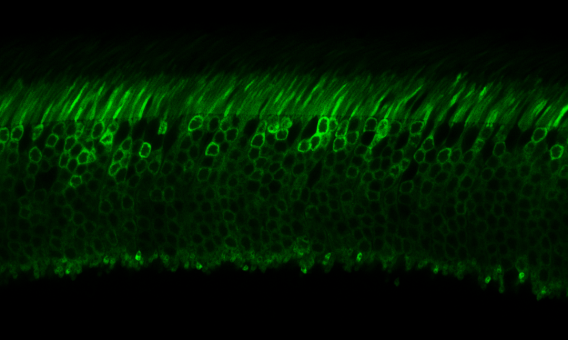 Vertical retinal section showing EGFP expression in rod photoreceptors.