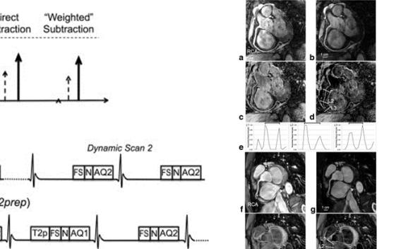 CMR sequences for pediatrics
