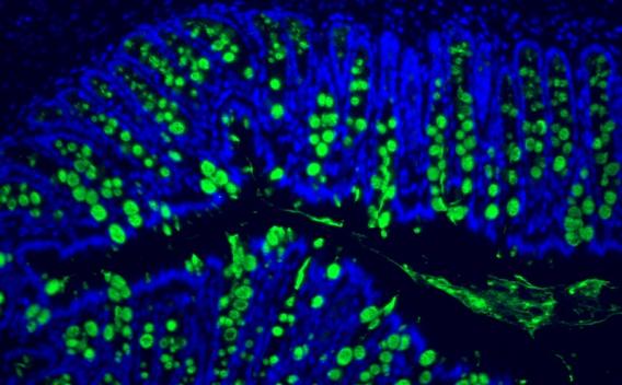 Intestinal immune homeostasis