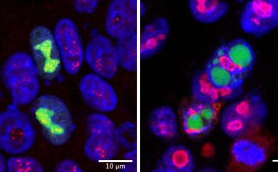 Cancer Cells in 3D