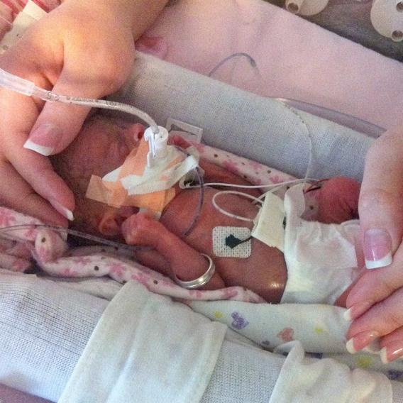 Premature baby with woman's hand cradling its head