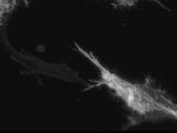 RPE1Htert TractinGFP Cell6 MIP Slice