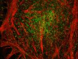 Hela Actin Clathrin