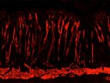 small-intestine