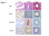 Immunophenotype of tubal fimbria