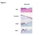 ESC and its precursors