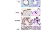 IMP3 and Nrf2