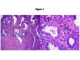 ESC and its precursors