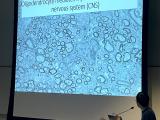 Tingxin Zhang 2024 OBI Research Day