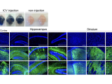 MIF AAV ICV injection in vivo