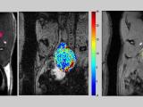 MRI of rat prostate: